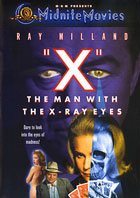 X: The Man With The X-Ray Eyes: Special Edition