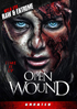 Open Wound