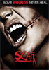 Scar