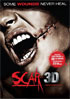 Scar 3D