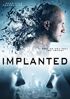 Implanted